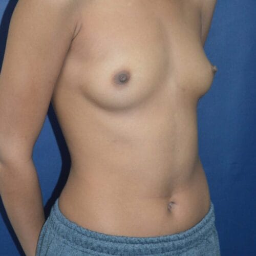 Before-2-2-1267x2048