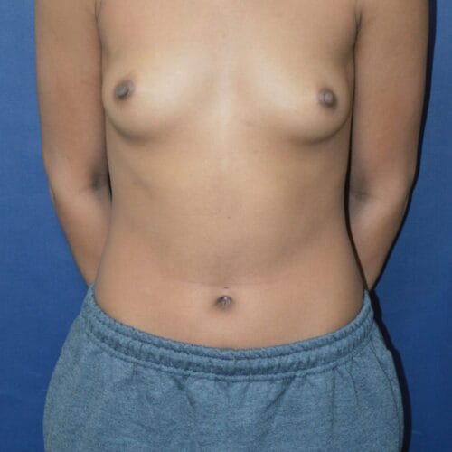 Before-5-1-1-1285x2048