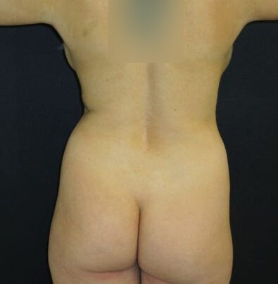 before_after_md-1057424-1600700-before-1602700544da8b6-420x560-1