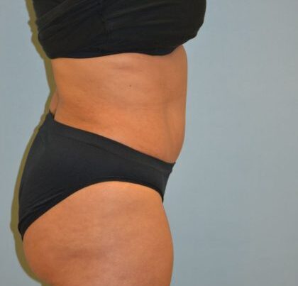 before_after_md-42138-1745966-after-1647368243499b2-420x632