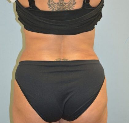 before_after_md-42138-1745966-after-1647368250112db-420x632