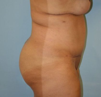 before_after_md-42138-1747357-after-16341603812cd00-420x631