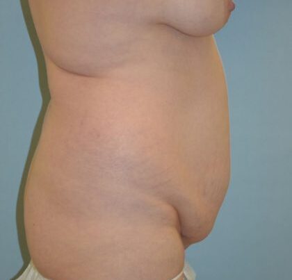 before_after_md-42138-1817067-before-1638989693c2a0f-420x632