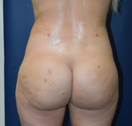 before_after_md-42138-1887718-after-1652201914eb309-420x631