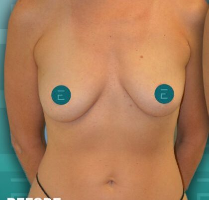 fatrans1-copy-420x474