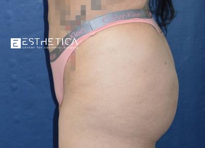 watermark-11-7