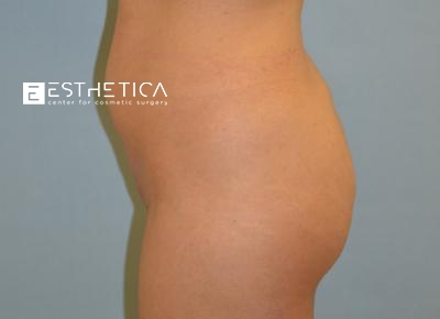 watermark-22-5