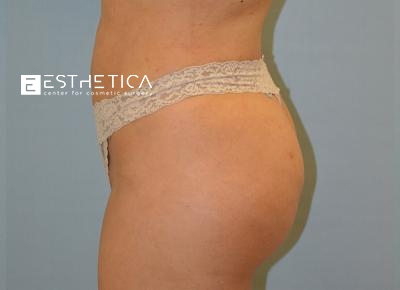 watermark-23-5