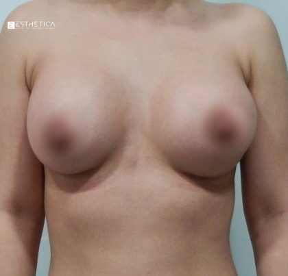 watermark-29-3-420x420