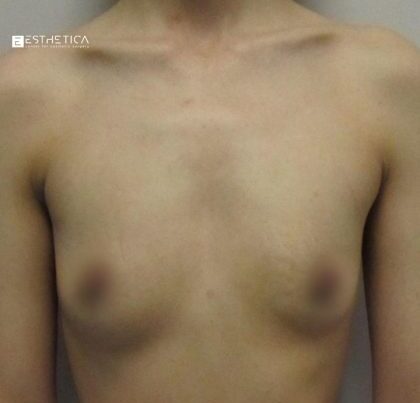 watermark-30-3-420x420