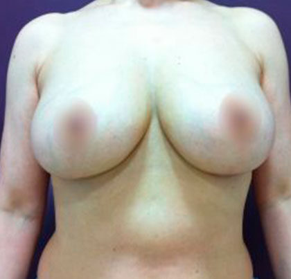 watermark-39-3-420x314-1