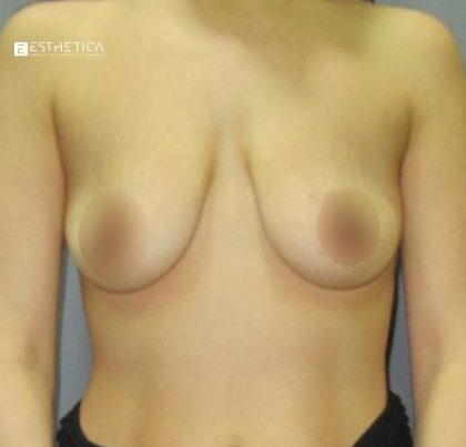 watermark-44-3-420x420