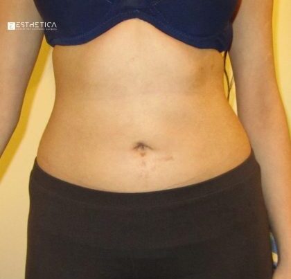 watermark-51-3-420x420