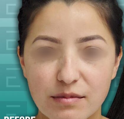 DianaBA-copy-420x464