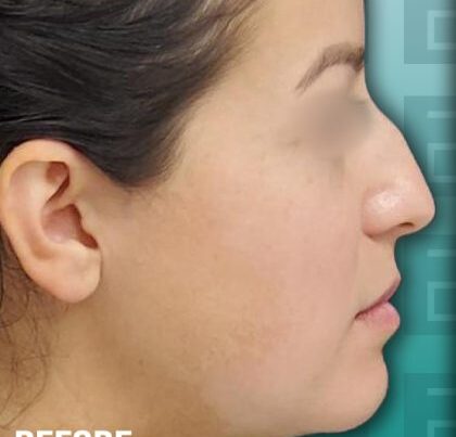 DianaBA2-copy-420x471