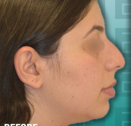 RowaidaZro-copy-420x468