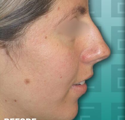 alexandraba-copy-420x473