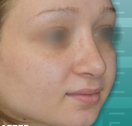 annabellemako-420x477