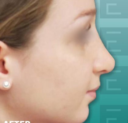 annabellemako2-420x468