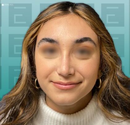 c3-a1-rhino-1-420x420