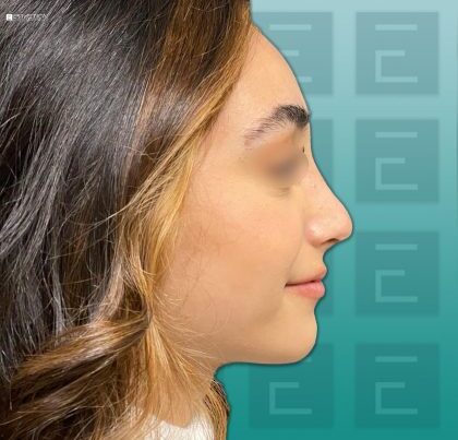 c3-a2-rhino-1-420x420