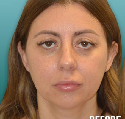 flodia1-copy-420x458