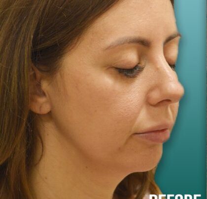 flodia2-copy-420x460