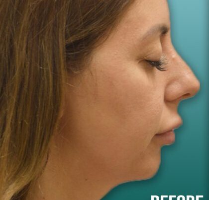 flodia3-copy-420x461