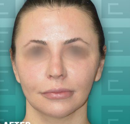 izabela_rhino1-420x469