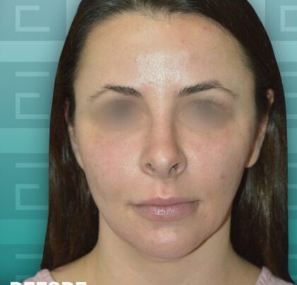 izabela_rhino1-copy-420x475