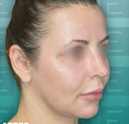 izabela_rhino2-420x474