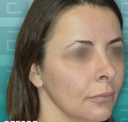 izabela_rhino2-copy-420x476