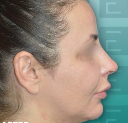 izabela_rhino3-420x475