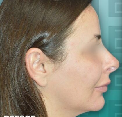 izabela_rhino3-copy-420x473