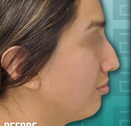 leslieBa1-copy-420x458