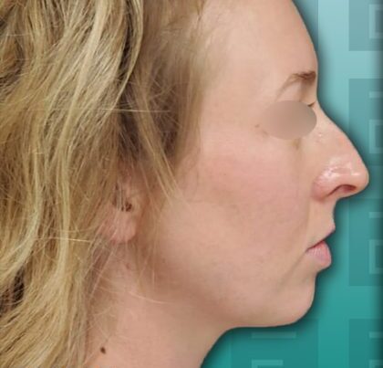 newportrhino-copy-420x484