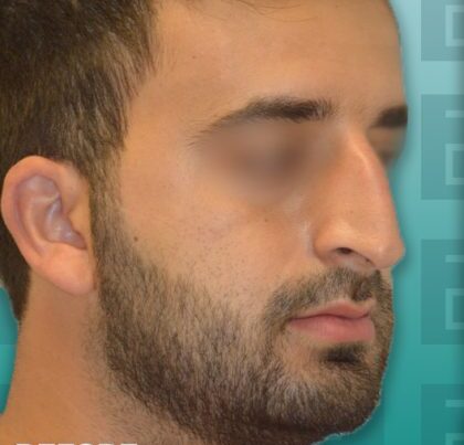 rhino1-copy-1-420x483