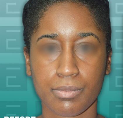 rudirhino1-copy-420x472