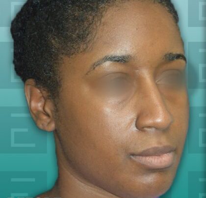 rudirhino2-copy-420x485