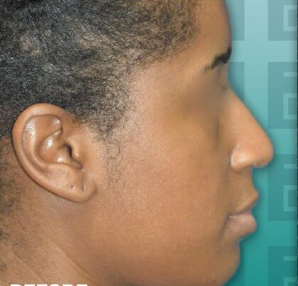 rudirhino3-copy-420x478