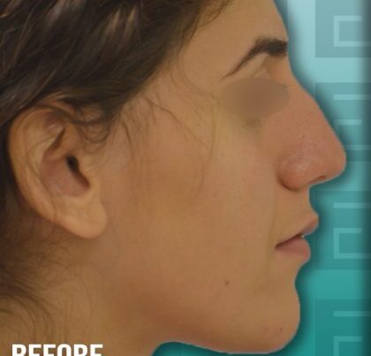 saratoma-copy-420x452