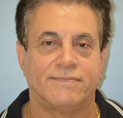 watermark-1-10-420x632