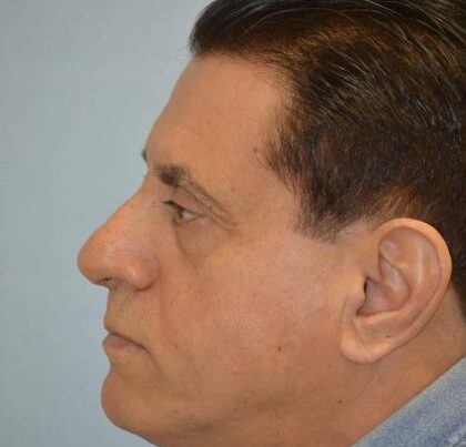 watermark-2-9-420x632