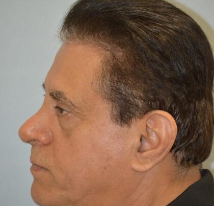 watermark-3-9-420x632