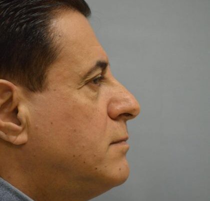 watermark-4-8-420x632