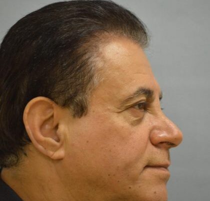 watermark-5-8-420x632