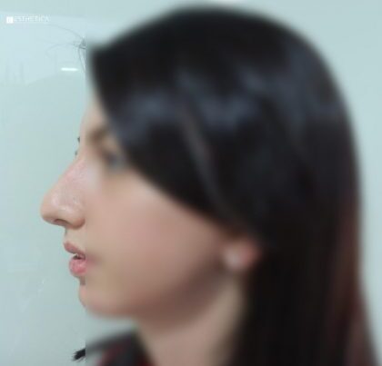 watermark-65-420x420