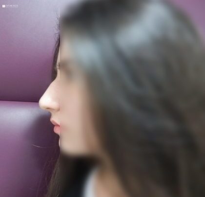 watermark-66-420x420