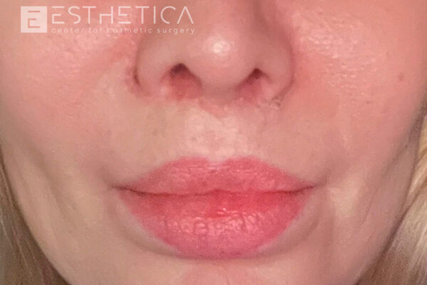 esthetica__before-eafter__24-09__1